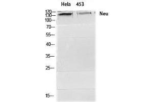 Western Blot (WB) analysis of HeLa 453 cells using Neu Polyclonal Antibody.