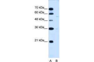 Western Blotting (WB) image for anti-Chromosome 19 Open Reading Frame 28 (C19orf28) antibody (ABIN2463998) (C19orf28 antibody)