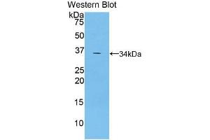 Western blot analysis of the recombinant protein. (TRAF5 antibody  (AA 181-437))