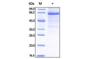Human LSECtin, Fc Tag on SDS-PAGE under reducing (R) condition. (CLEC4G Protein (AA 55-293) (Fc Tag))