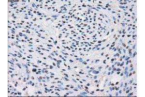 Immunohistochemical staining of paraffin-embedded colon tissue using anti-FHmouse monoclonal antibody.