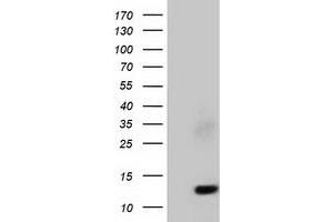 HEK293T cells were transfected with the pCMV6-ENTRY control (Left lane) or pCMV6-ENTRY FSHB (Right lane) cDNA for 48 hrs and lysed. (FSHB antibody)