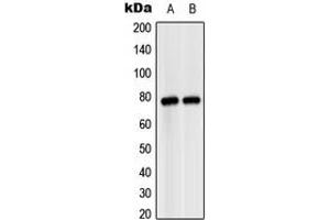 Western blot analysis of MASP2 expression in HeLa (A), SP2/0 (B) whole cell lysates. (MASP2 antibody  (Center))