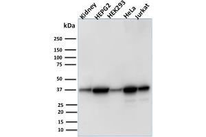 AKR1B1 antibody