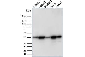 Western Blot Analysis of Human Kidney tissue, Human HepG2, HEK293, HeLa and Jurkat cell lysate using AKR1B1 Mouse Monoclonal Antibody (CPTC-AKR1B1-3).