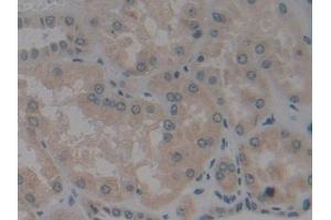 Immunohistochemistry (IHC) image for anti-Bcl2 Modifying Factor (BMF) (AA 1-181) antibody (ABIN7442702)