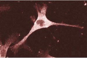 Immunofluorescence staining of human endothelial cells. (ENAH antibody  (AA 415-541))