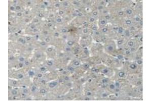 IHC-P analysis of Human Liver Tissue, with DAB staining. (STAM2 antibody  (AA 1-377))