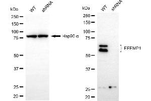 anti-Fibulin 3 (FBLN3) antibody
