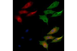 ABIN6264831 and ABIN6279042 staining  cells by IF/ICC.