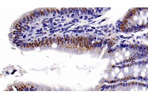 Immunohistochemistry (IHC) image for anti-Histone Deacetylase 1 (HDAC1) (AA 1-482) antibody (ABIN7426493)