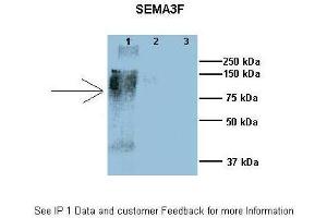 Researcher: Dr. (SEMA3F antibody  (N-Term))