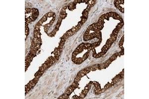 Immunohistochemical staining of human prostate with SCARF2 polyclonal antibody  strong cytoplasmic positivity in glandular cells at 1:200-1:500 dilution.