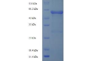 SDS-PAGE (SDS) image for Matrix Metallopeptidase 3 (Stromelysin 1, Progelatinase) (MMP3) (AA 102-477), (partial) protein (His-SUMO Tag) (ABIN5709947)