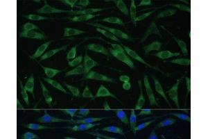 Immunofluorescence analysis of L929 cells using DNM3 Polyclonal Antibody at dilution of 1:100 (40x lens). (Dynamin 3 antibody)