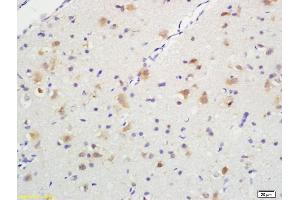 Formalin-fixed and paraffin embedded rat brain tissue labeled with Anti-Phospho-TrkA (Tyr490) /TrkB (Tyr516) Polyclonal Antibody, Unconjugated (ABIN746603) at 1:200, followed by conjugation to the secondary antibody and DAB staining (TRKA antibody  (pTyr496))