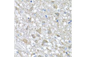 Immunohistochemistry of paraffin-embedded rat brain using VPS37A antibody (ABIN5975733) at dilution of 1/100 (40x lens). (VPS37A antibody)