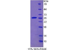 SDS-PAGE analysis of Human CYP2D6 Protein. (CYP2D6 Protein)