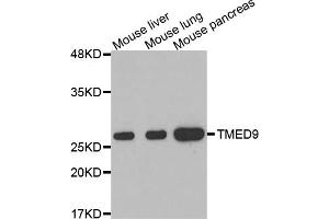Western blot analysis of extracts of various cell lines, using TMED9 antibody. (TMED9 antibody)