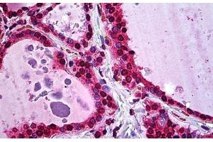 Human Thyroid: Formalin-Fixed, Paraffin-Embedded (FFPE) (ATF5 antibody  (AA 101-200))