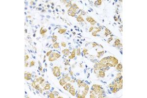 Immunohistochemistry of paraffin-embedded human stomach using EDIL3 antibody (ABIN6130999, ABIN6139930, ABIN6139932 and ABIN6217370) at dilution of 1:100 (40x lens). (EDIL3 antibody  (AA 250-480))