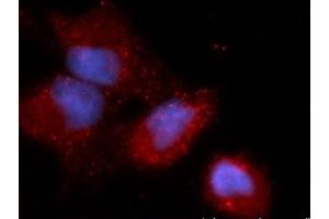 Immunofluorescence (IF) image for anti-Calcium and Integrin-Binding Protein 1 (CIB1) (AA 1-191) antibody (APC) (ABIN5564730) (CIB1 antibody  (AA 1-191) (APC))