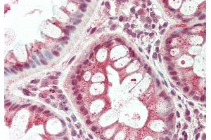 Rabbit Anti-TSC22D1 antibody Catalog Number: ARP36279 Formalin Fixed Paraffin Embedded Tissue: Human Colon Primary antibody Concentration: 1:100 Secondary Antibody: Donkey anti-Rabbit-Cy3 Secondary Antibody Concentration: 1:200 Magnification: 20x Exposure Time: 0. (TSC22D1 antibody  (C-Term))
