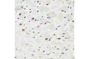 Immunohistochemistry of paraffin-embedded rat brain using SFPQ antibody (ABIN5970351) at dilution of 1/100 (40x lens). (SFPQ antibody)