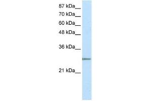 Transfected 293T; WB Suggested Anti-C20ORF20 Antibody Titration: 2. (MRGBP antibody  (N-Term))
