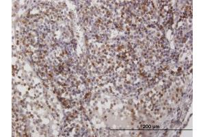 Immunoperoxidase of purified MaxPab antibody to CD2 on formalin-fixed paraffin-embedded human lymph node. (CD2 antibody  (AA 1-351))