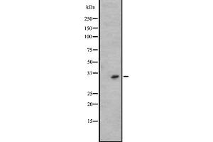 Western blot analysis of KLK6 expression in A431 whole cell lysate ,The lane on the left is treated with the antigen-specific peptide. (Kallikrein 6 antibody  (C-Term))