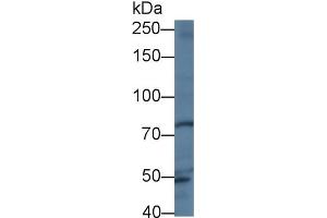 Western Blot; Sample: Human Hela cell lysate; Primary Ab: 1µg/ml Rabbit Anti-Human TRO Antibody Second Ab: 0. (TRO antibody  (AA 444-642))