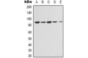 Western blot analysis of FAP alpha expression in Hela (A), MCF7 (B), NIH3T3 (C), mouse kidney (D), rat liver (E) whole cell lysates.