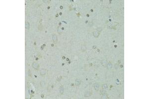 Immunohistochemistry of paraffin-embedded rat brain using GTF2H2C antibody (ABIN5973022) at dilution of 1/100 (40x lens). (GTF2H2C antibody)