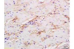 Formalin-fixed and paraffin embedded human colon labeled with Rabbit Anti phospho-LRP1(Ser4523) Polyclonal Antibody, Unconjugated (ABIN801648) at 1:200 followed by conjugation to the secondary antibody and DAB staining (LRP1 antibody  (pSer4523))