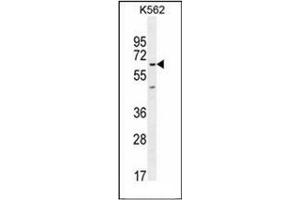 Western blot analysis of KBTBD5 Antibody (Center) in K562 cell line lysates (35ug/lane).