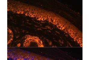 Immunofluorescence analysis of Rat skin using TYR Polyclonal Antibody at dilution of 1:100. (TYR antibody)