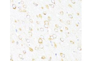 Immunohistochemistry of paraffin-embedded Rat brain using DDX3Y Polyclonal Antibody at dilution of 1:100 (40x lens). (DDX3Y antibody)