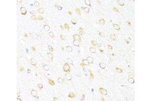Immunohistochemistry of paraffin-embedded Rat brain using DDX3Y Polyclonal Antibody at dilution of 1:100 (40x lens).