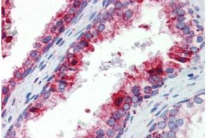 Human Prostate (formalin-fixed, paraffin-embedded) stained with BCL11A antibody ABIN462216 followed by biotinylated goat anti-rabbit IgG secondary antibody ABIN481713, alkaline phosphatase-streptavidin and chromogen. (BCL11A antibody  (N-Term))