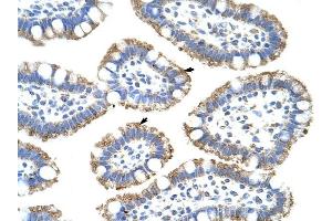SF3B4 antibody was used for immunohistochemistry at a concentration of 4-8 ug/ml to stain Epithelial cells of intestinal villus (arrows) in Human Intestine.