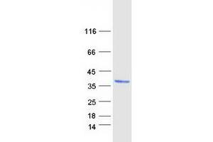 Validation with Western Blot (DHRS3 Protein (Myc-DYKDDDDK Tag))