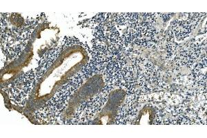 IHC analysis of CDC123 using anti-CDC123 antibody (ABIN7599284). (CDC123 antibody  (AA 1-336))
