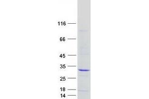 Western Blotting (WB) image for Chromosome 19 Open Reading Frame 40 (C19ORF40) protein (Myc-DYKDDDDK Tag) (ABIN2720653)