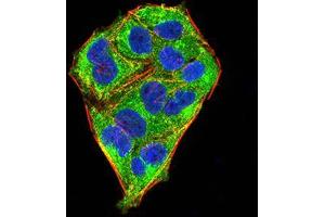 Immunofluorescence analysis of Hela cells using MECP2 mouse mAb (green). (MECP2 antibody  (AA 7-148))