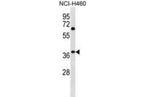 Western Blotting (WB) image for anti-NHL Repeat Containing 3 (NHLRC3) antibody (ABIN3001284)