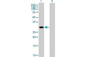 Western Blot analysis of PSMB8 expression in transfected 293T cell line by PSMB8 MaxPab polyclonal antibody. (PSMB8 antibody  (AA 1-272))