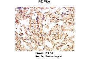 Sample Type: Human placental tissue  Primary Antibody Dilution: 1:100Secondary Antibody: Goat anti rabbit-HRP  Secondary Antibody Dilution: 1:00,000Color/Signal Descriptions: Brown: PDE5APurple: Haemotoxylin  Gene Name: PDE5A Submitted by: Dr.