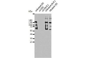 ROBO4 antibody  (full length)