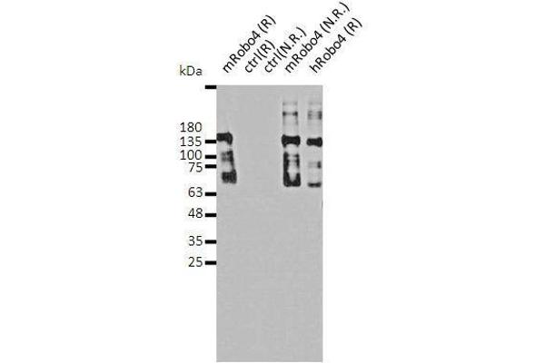ROBO4 antibody  (full length)